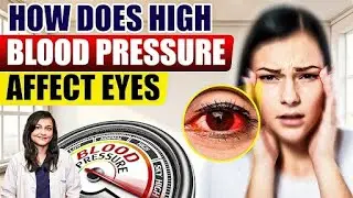 How Does High Blood Pressure Affect Eyes 👁️ ? | Best Way Manage Your High Blood Pressure