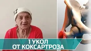 Чудо-укол для лечения коксартроза!