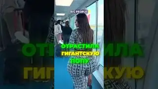 ОТРАСТИЛА ГИГАНТСКУЮ ПОПУ И ЖАЛУЕТСЯ 🐍