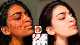 Face Smooth kaise kare |Girl Face Smooth Editing|Hard Smooth photo editing| #facesmoothediting #edit