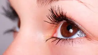 Куз учиши сабаблари