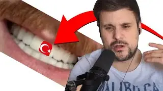 Daves take on Turkey Teeth 🇹🇷 + Memes