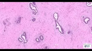 Breast (Male): Gynaecomastia Microscopy (Talking slide)