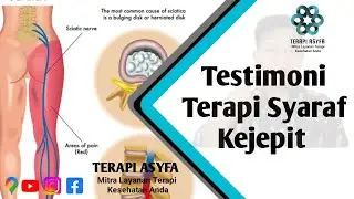 Testimoni Terapi Syaraf Kejepit