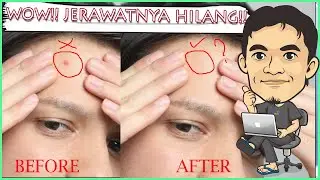 2 Cara Hilangkan Jerawat di Photoshop CS6 Dengan Mudah! - Pemula Juga Bisa Menghilangkan Jerawat ini