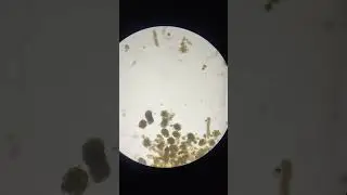 siswa SD pun bisa. Merekam bakteri plankton dengan hp.