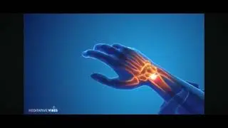 la puissance des ondes alpha %