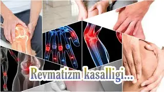 Revmatizm kasalliklari_Ревматизм касалликлари.