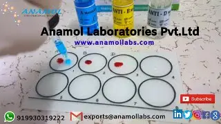 Blood Grouping Test Procedure