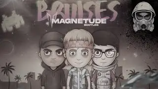 Fox Stevenson - Bruises (Magnetude Bootleg) [Free Download]