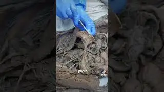 Anatomía del píloro