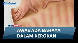 INI MANFAAT DAN RESIKO KEROKAN, Jangan Dilakukan Pada Orang Diabetes