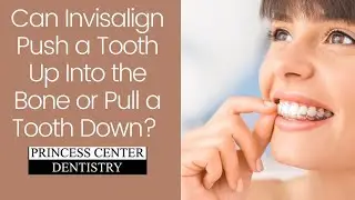 Can Invisalign Push a Tooth Up Into the Bone or Pull a Tooth Down?
