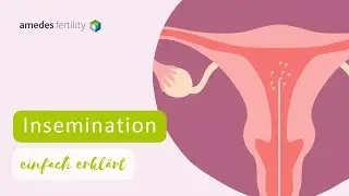 Kinderwunschbehandlung durch Insemination: Alles, was du wissen musst 💡👶