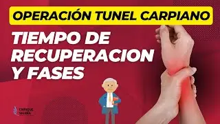 TÚNEL CARPIANO: TIEMPO DE RECUPERACION Y FASES ✅