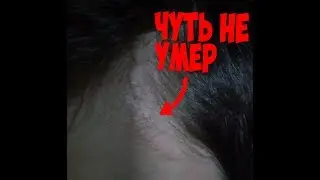 КАК Я ЧУТЬ НЕ УМЕР!!! ИСТОРИЯ ИЗ ЖИЗНИ!!!