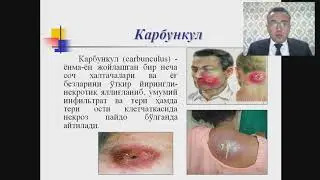Тери ва тери ости ёғ тўқималарини ймрмнгли касалликлари