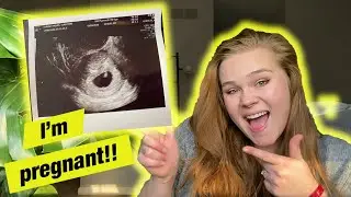I'M PREGNANT! | 9 Week Update