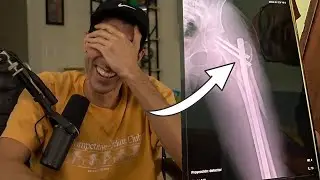 How Stoopzz broke his hip while on vacation...