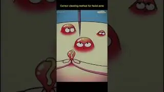 Method for facial acne