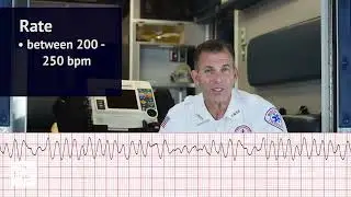 Ventricular Fibrillation (V-Fib) EKG/ECG (ACLS Rhythm Strips) | Training Video