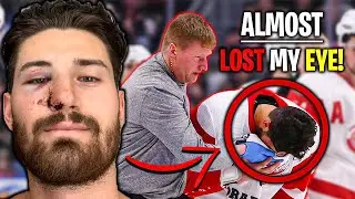 Worst Injury In My NHL Career