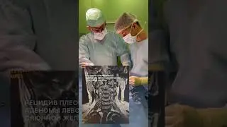 Аденома слюнной железы