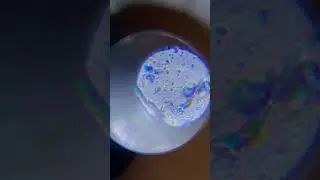 Соскоб из уха изучаю.