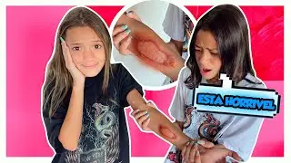 SOMETHING HAPPENED WITH MY ARM AND MY SISTER CARED FOR ME - MILLENA AND MANU MAIA