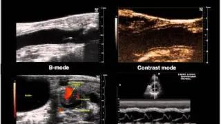 March 2014 Webinar - Imaging Angiogenesis Part 1