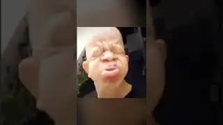 Bald wrinkly man sneezing [reverse]