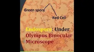How to perform Endospore staining  by Schaeffer-Fulton Method (Olympus binocular microscope)