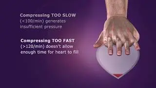 Conventional CPR Overview