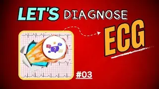 ECG Interpretation | ECG Quiz 03 🩺✨ | LET'S DIAGNOSE ECG - Series. |ECG Test