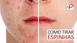 Como Tirar Espinhas no Photoshop (A Melhor Técnica)
