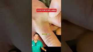 These are common in barbers and pet groomers 