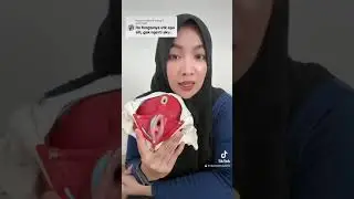 FUNCTION OF THE 3-HOLE DISPLAY IN THE WOMAN'S PELVES