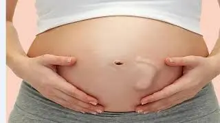 Естественные роды или кесарево сечение  Незапланированное кесарево