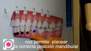 ortodoncia postural