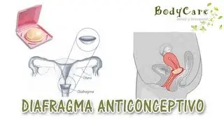 Diafragma femenino