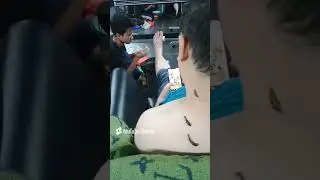 terapi lintah untuk kesehatan pria.