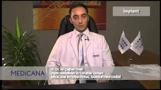 Medicana International Samsun Hastanesi Dr. Dt. Ali Çağhan Ovalı Konu: İmplant