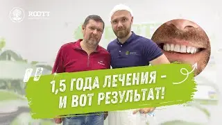 Отзыв нашего пациента об одноэтапной имплантации нижней челюсти 💚