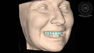 Cone Beam Computed Tomography - Know its Secrets