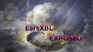 EarsXBL EXPOSED 