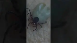 PARALYSIS TICKS : The Hidden Threat To Your Dogs Life.🥲