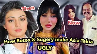 Aisha Takia Left Instagram After Brutally Troll for Unrecognisable Look & Botox