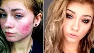 the power of makeup - after and before