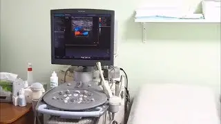 УЗИ экспертного класса на Siemens Sonoline Antares