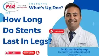 How Long Do Stents Last In Legs | Dr. Kumar Madassery